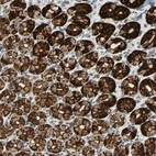 Anti-CMC2 Antibody