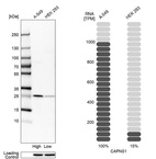 Western blot analysis in human cell lines A-549 and HEK293 using Anti-CAPNS1 antibody. Corresponding CAPNS1 RNA-seq data are presented for the same cell lines. Loading control: Anti-HSP90B1.