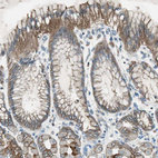 Anti-NKAIN1 Antibody