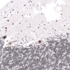 Anti-KANSL1 Antibody
