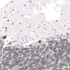 Anti-KANSL1 Antibody