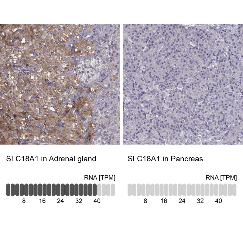 Anti-SLC18A1 Antibody