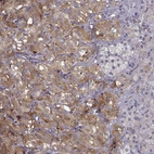 Immunohistochemical staining of human adrenal gland shows moderate granular cytoplasmic positivity in glandular cells.