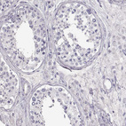 Immunohistochemical staining of human testis shows no positivity in cells in seminiferous ducts as expected.