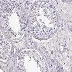 Immunohistochemical staining of human testis shows no positivity in cells in seminiferous ducts as expected.