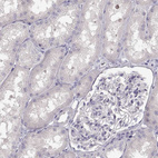 Immunohistochemical staining of human kidney shows no positivity in cells in tubules as expected.