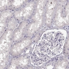 Immunohistochemical staining of human kidney shows no positivity in cells in tubules as expected.
