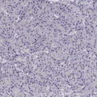 Immunohistochemical staining of human pancreas shows no expression in exocrine glandular cells as expected.