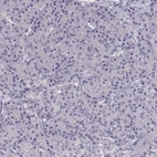 Immunohistochemical staining of human pancreas shows no expression in exocrine glandular cells as expected.