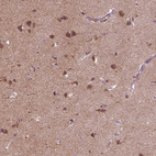 Immunohistochemical staining of human cerebral cortex shows strong cytoplasmic positivity in neurons and moderate cytoplasmic positivity in neuropil.