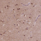Immunohistochemical staining of human cerebral cortex shows strong cytoplasmic positivity in neurons and moderate cytoplasmic positivity in neuropil.