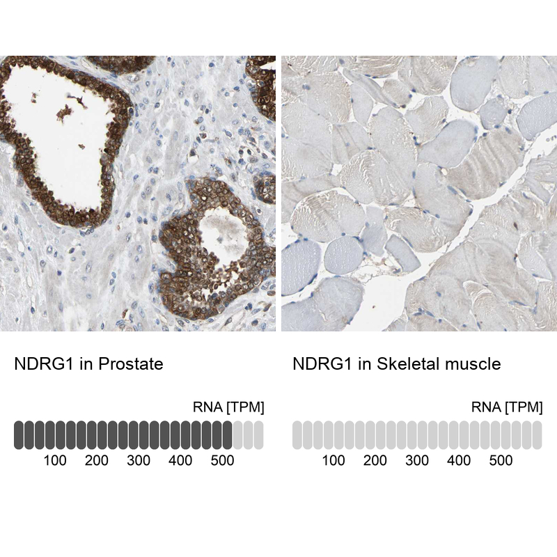 Anti-NDRG1 Antibody