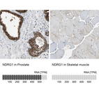 Anti-NDRG1 Antibody