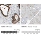 Anti-NDRG1 Antibody
