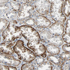 Immunohistochemical staining of human kidney shows moderate membranous positivity in cells in tubules.