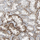 Immunohistochemical staining of human kidney shows moderate membranous positivity in cells in tubules.