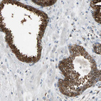 Immunohistochemical staining of human prostate shows strong membranous positivity in glandular cells.