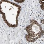 Immunohistochemical staining of human prostate shows strong membranous positivity in glandular cells.