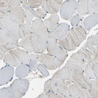 Immunohistochemical staining of human skeletal muscle shows no membranous positivity in myocytes as expected.