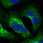 Immunofluorescent staining of human cell line U-2 OS shows localization to cytosol & microtubules.