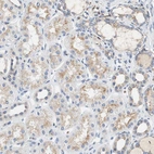 Immunohistochemical staining of human kidney shows moderate cytoplasmic positivity in cells in tubules.