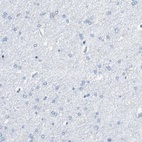 Immunohistochemical staining of human cerebral cortex shows low expression as expected.