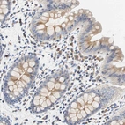 Immunohistochemical staining of human colon shows moderate cytoplasmic positivity in glandular cells.
