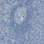 Immunohistochemical staining of human tonsil shows no positivity in lymphoid cells as expected.