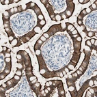 Immunohistochemical staining of human small intestine shows strong positivity in apical membrane in glandular cells.