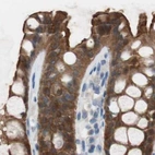Immunohistochemical staining of human colon using Anti-VIL1 antibody HPA006884.