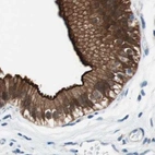 Immunohistochemical staining of human gallbladder using Anti-VIL1 antibody HPA006884.