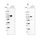 Western blot analysis using Anti-VIL1 antibody HPA006884 (A) shows similar pattern to independent antibody HPA006885 (B).