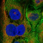 Immunofluorescent staining of human cell line CACO-2 shows localization to plasma membrane.