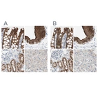 Anti-VIL1 Antibody
