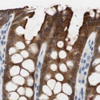 Immunohistochemical staining of human colon using Anti-VIL1 antibody HPA006885.