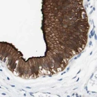 Immunohistochemical staining of human gallbladder using Anti-VIL1 antibody HPA006885.