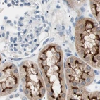 Immunohistochemical staining of human kidney using Anti-VIL1 antibody HPA006885.