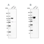 Western blot analysis using Anti-VIL1 antibody HPA006885 (A) shows similar pattern to independent antibody HPA006884 (B).