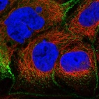 Immunofluorescent staining of human cell line CACO-2 shows localization to plasma membrane.
