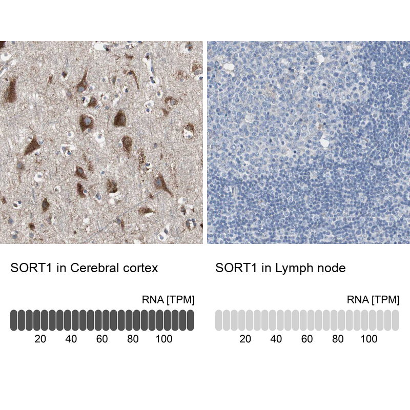 Anti-SORT1 Antibody
