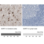 Anti-SORT1 Antibody