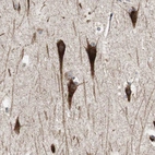 Immunohistochemical staining of human hippocampus shows strong cytoplasmic positivity in neurons.