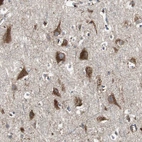 Immunohistochemical staining of human cerebral cortex shows moderate to strong cytoplasmic positivity in neurons.