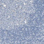 Anti-SORT1 Antibody