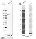 Western blot analysis in human cell lines SK-MEL-30 and PC-3 using Anti-SORT1 antibody. Corresponding SORT1 RNA-seq data are presented for the same cell lines. Loading control: Anti-GAPDH.