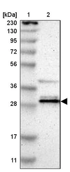 Lane 1: Marker [kDa] 230, 130, 95, 72, 56, 36, 28, 17, 11_br/_Lane 2: Human cell line RT-4