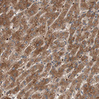 Anti-GLYCTK Antibody