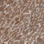 Anti-GLYCTK Antibody