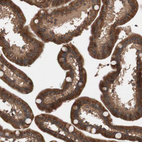 Immunohistochemical staining of human small intestine shows strong cytoplasmic positivity in glandular cells.