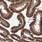 Immunohistochemical staining of human small intestine shows strong cytoplasmic positivity in glandular cells.